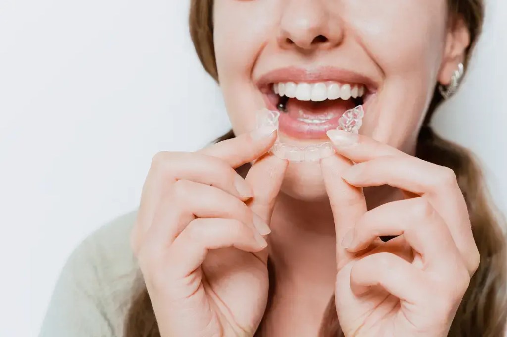 How Long Does Invisalign Treatment&nbsp;Take?